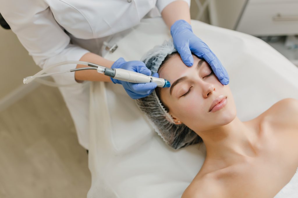 Microneedlingbehandlung bei Goharsbeautywelt